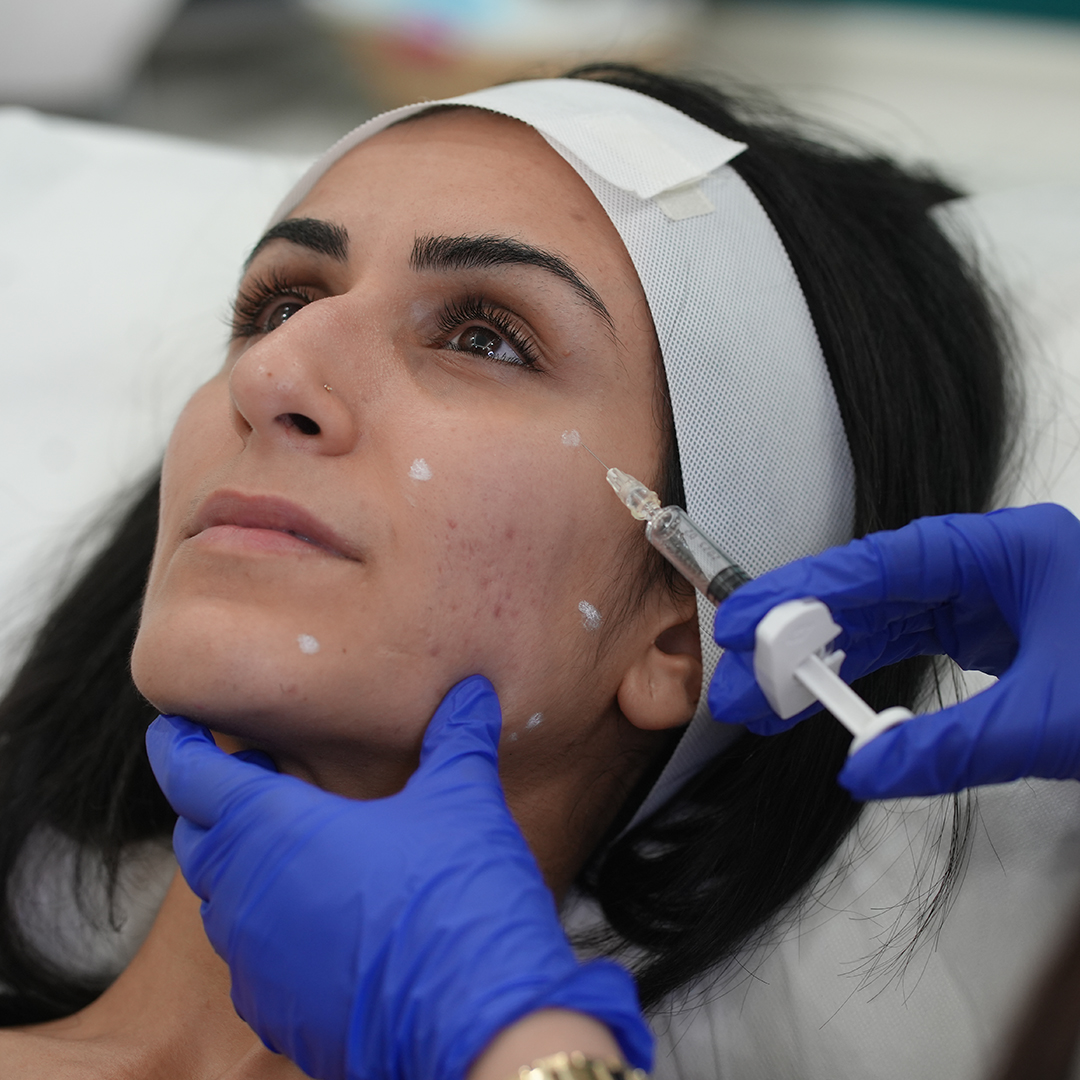 AT A GLANCE second copy