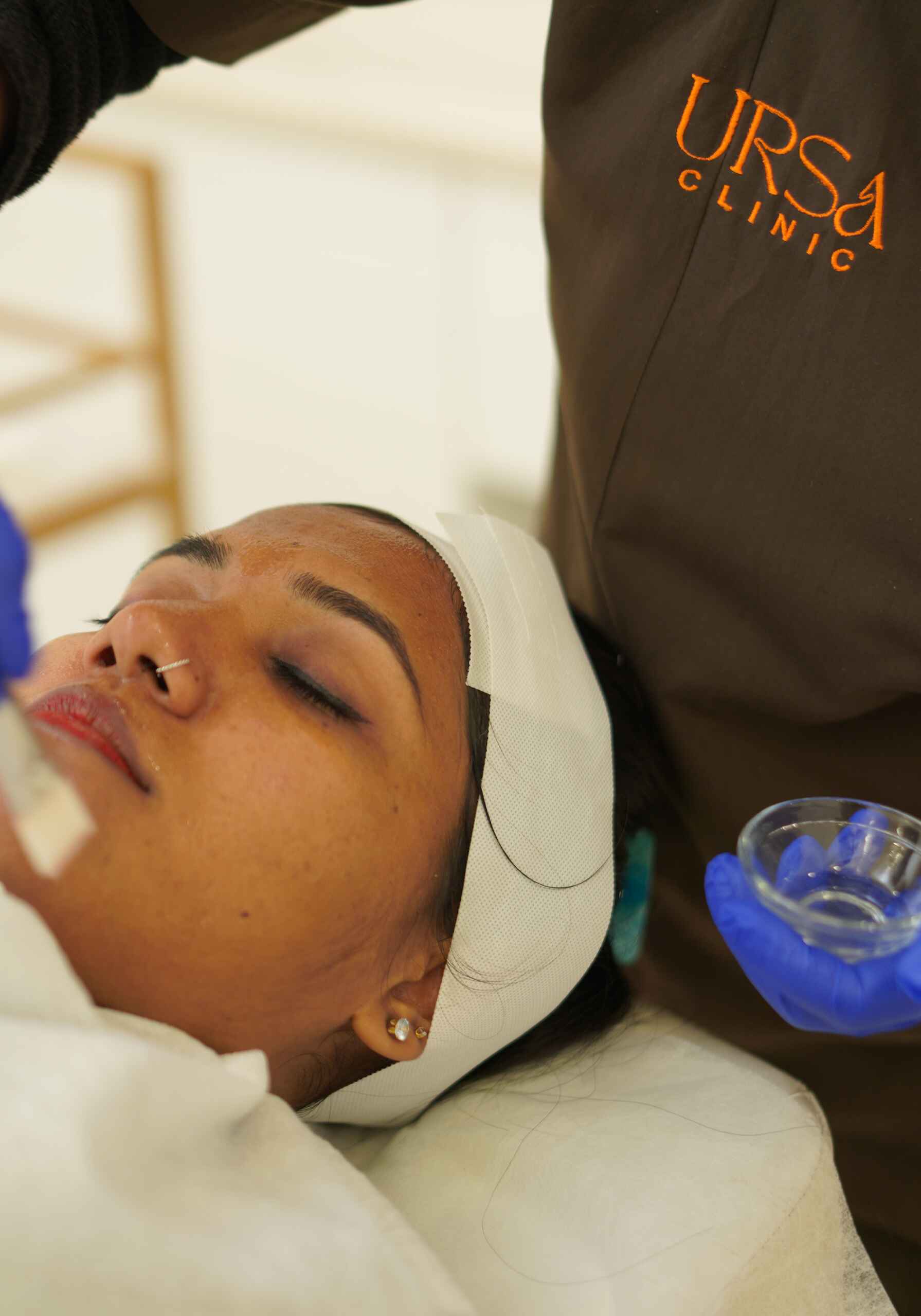 Chemical Peel Treatment (2)