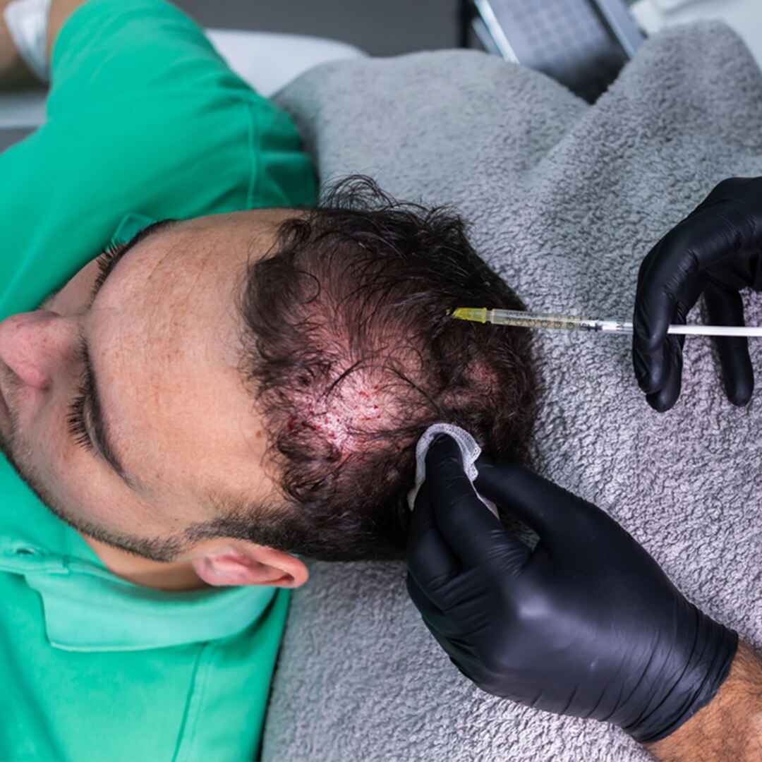 GFC Therapy (2)