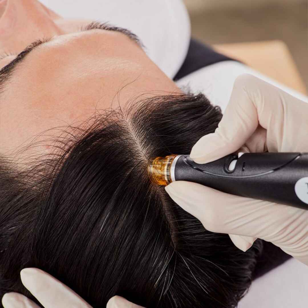 Keravive Scalp Treatment (3)