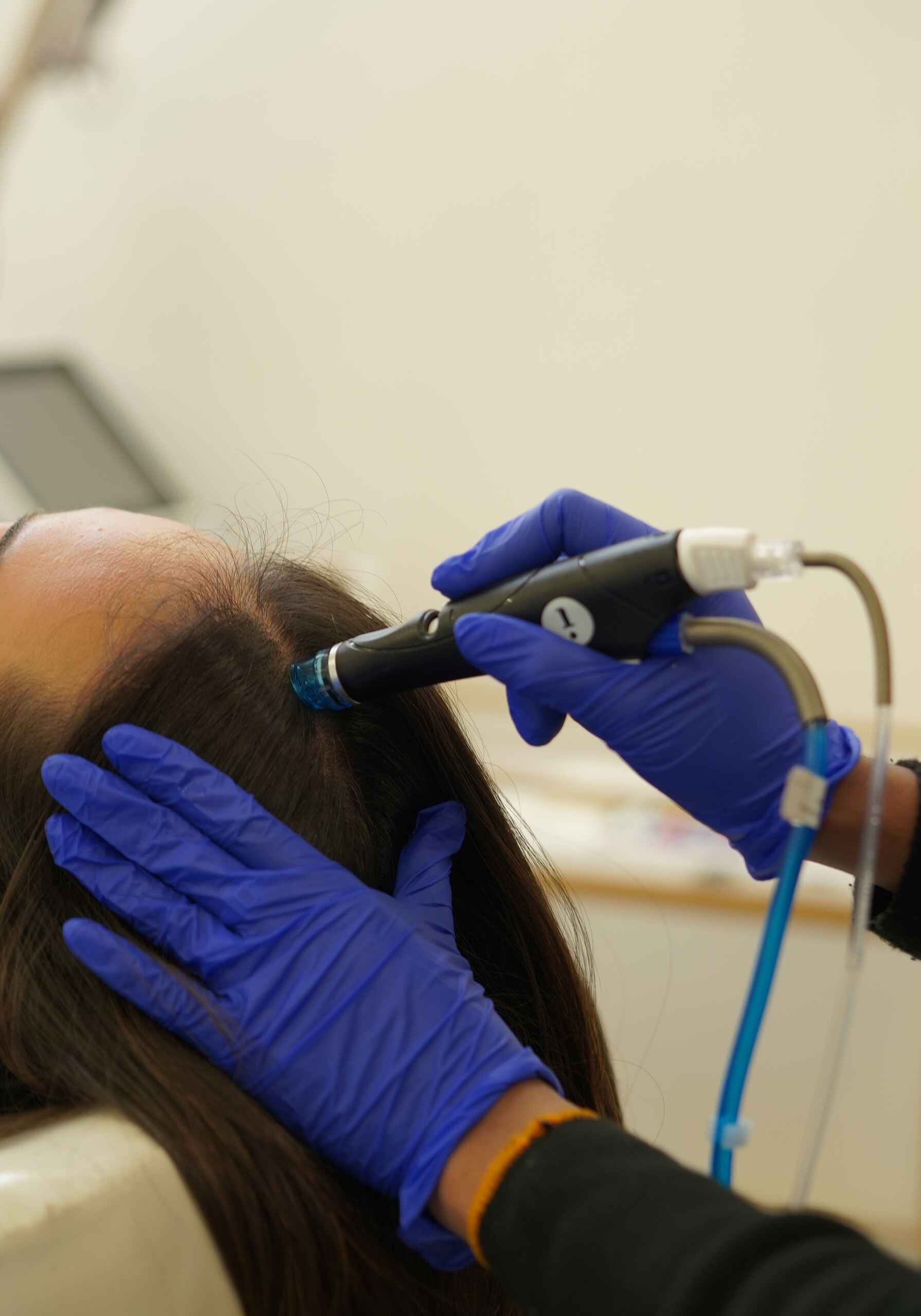 Keravive Scalp Treatment (4)