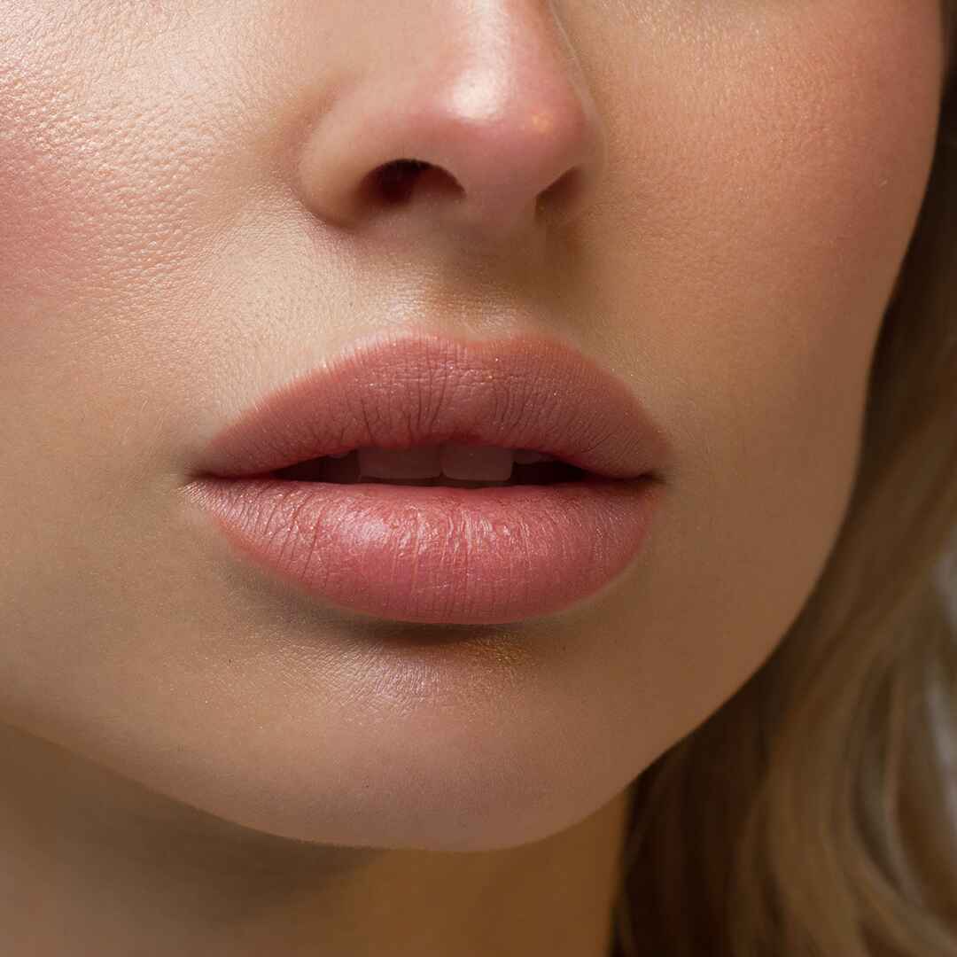 Lip Augmentation (3)