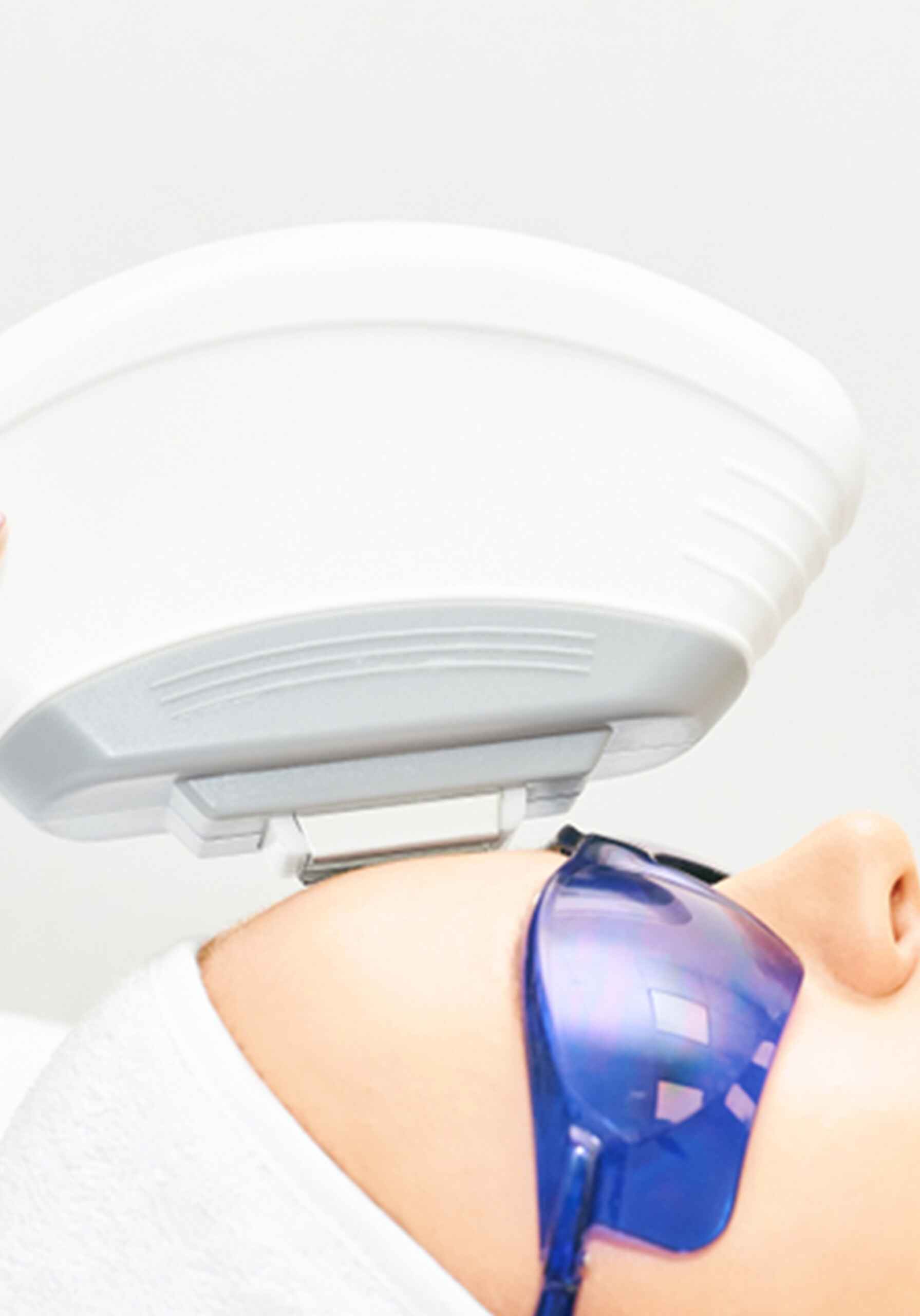 PHOTO FACIAL (IPL) (1)
