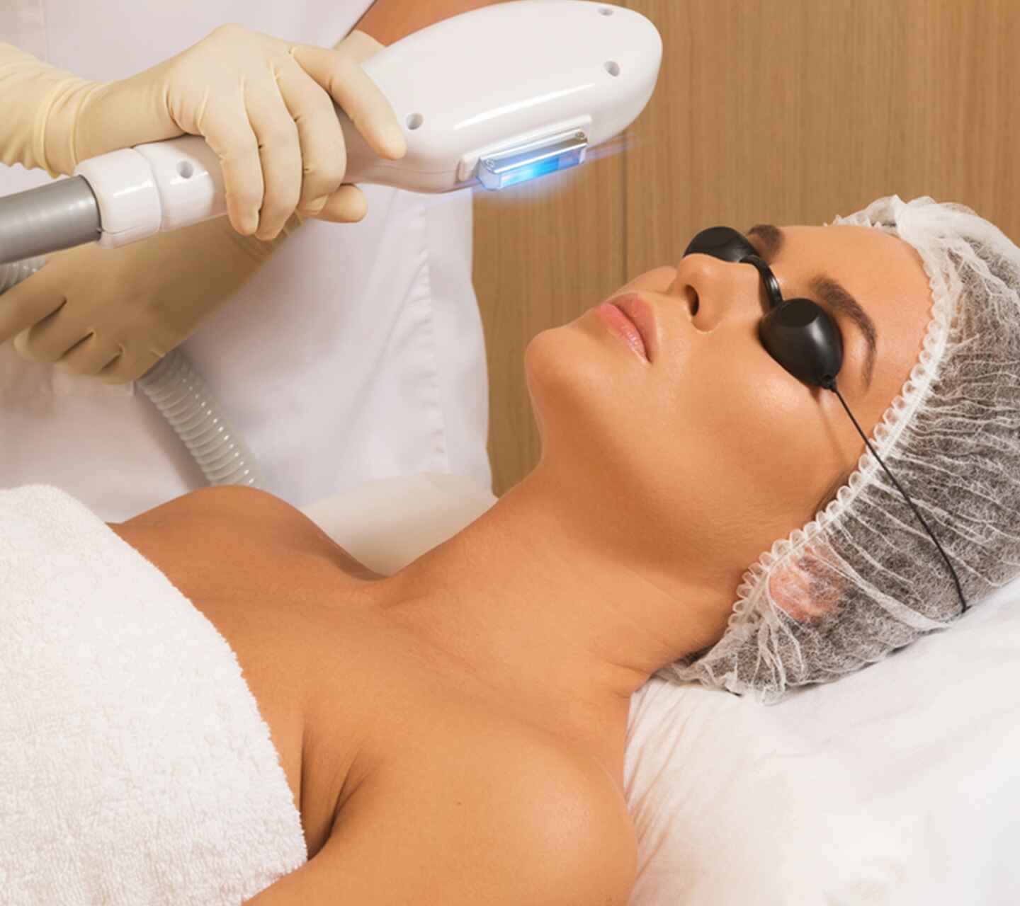 PHOTO FACIAL (IPL) (2)