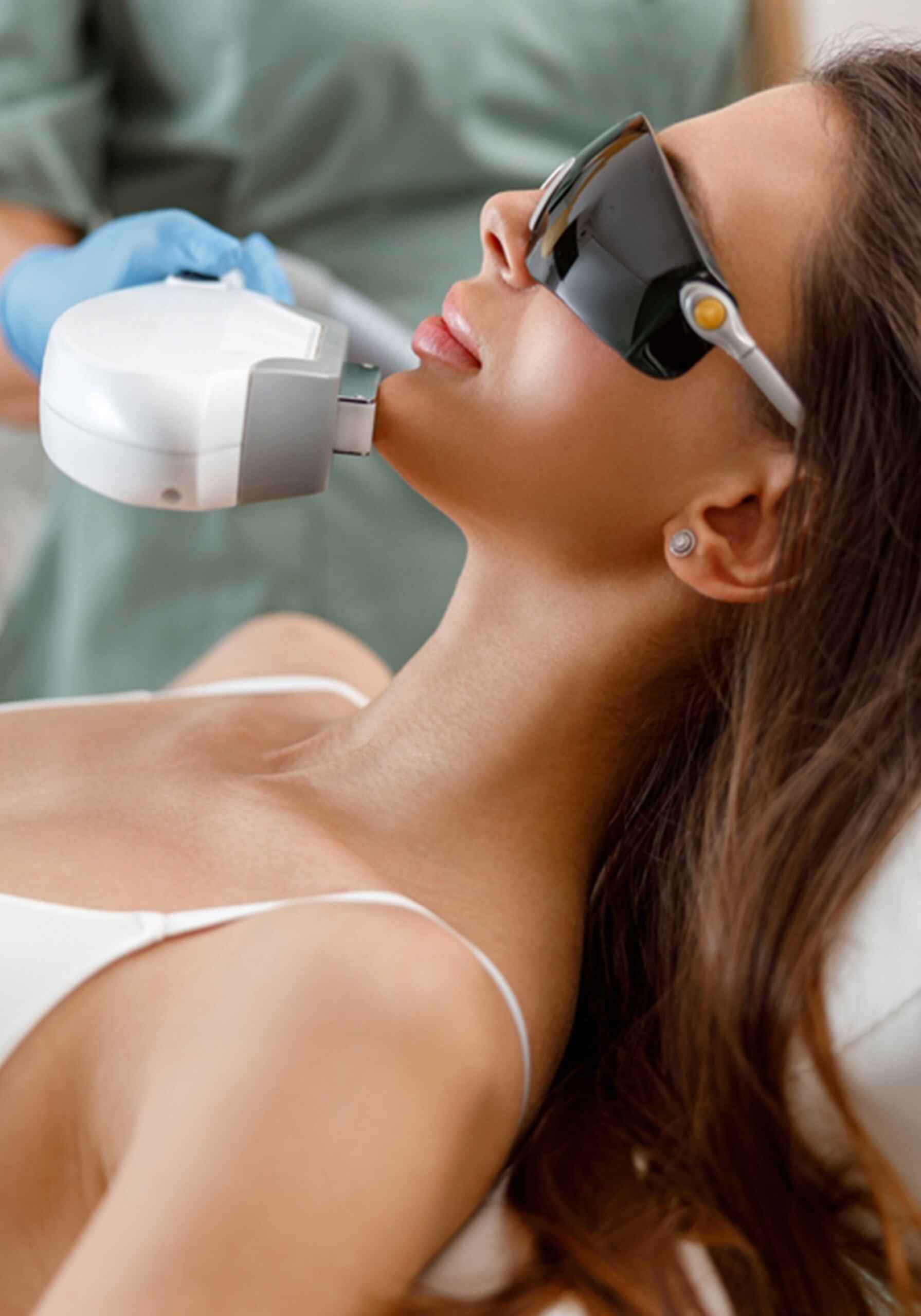 PHOTO FACIAL (IPL) (3)