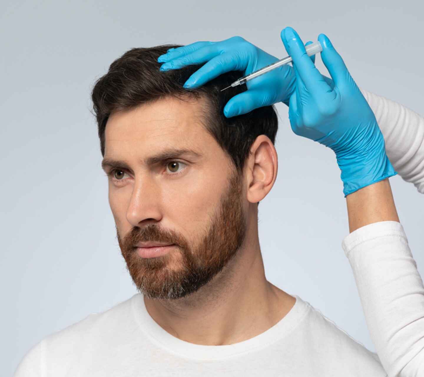 prp hair loss (1)