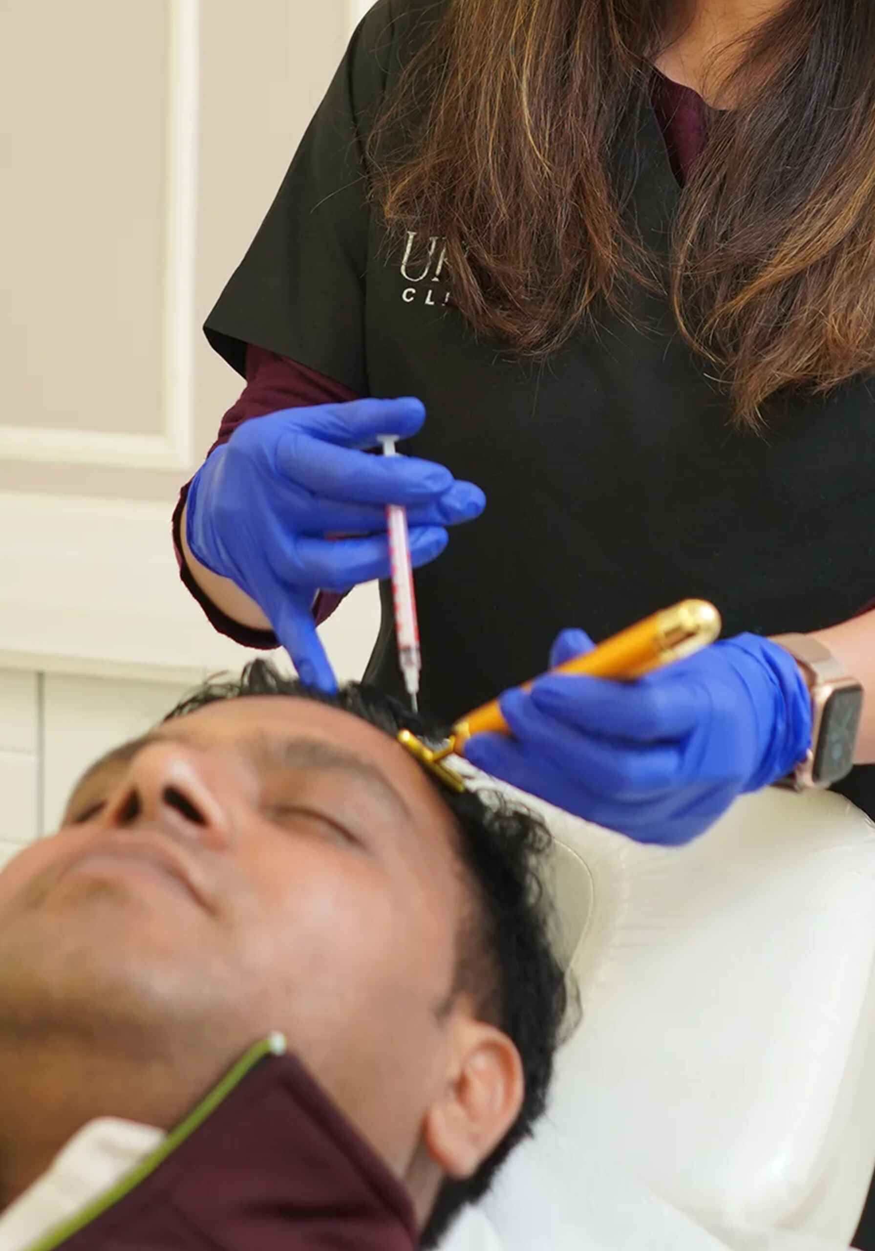 prp hair loss (3)