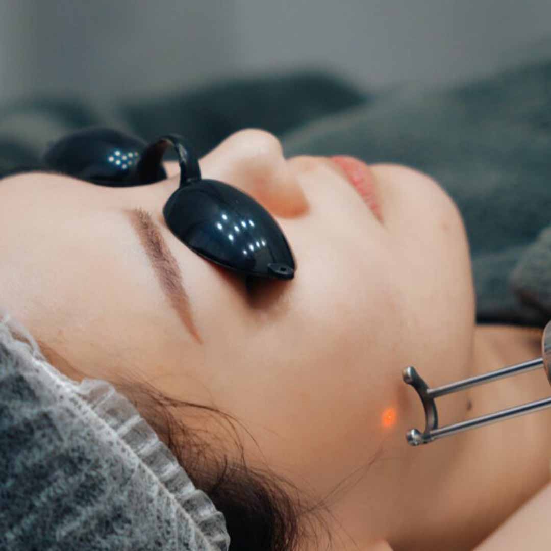 Pico Laser (3)