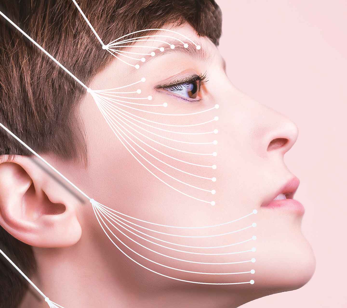thread lift (2)