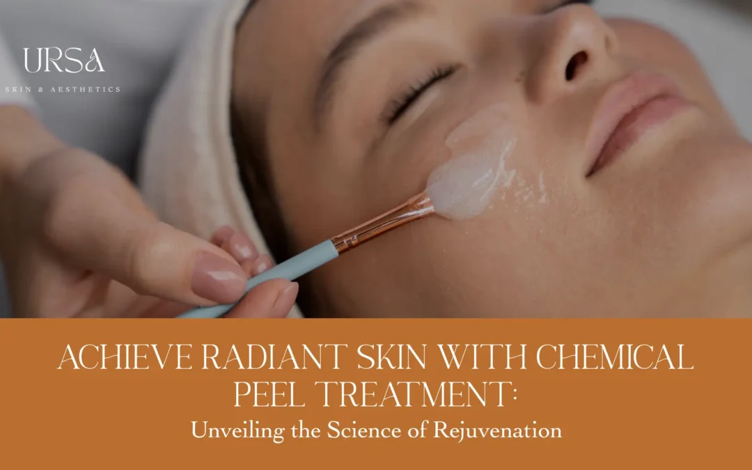 Reveal Radiant Skin with Chemical Peel Treatment