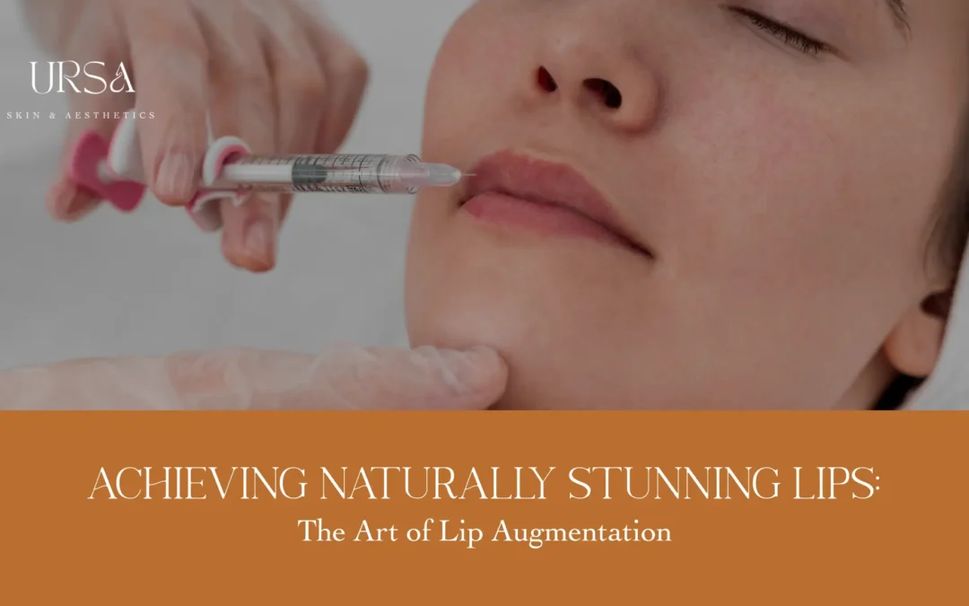 Achieve Stunning Lips with Lip Augmentation