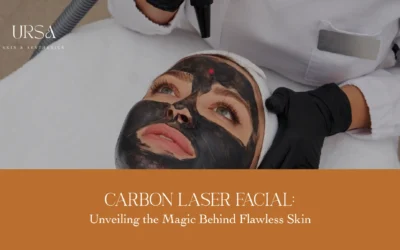Carbon Laser Facial Treatment for Glow & Clarity