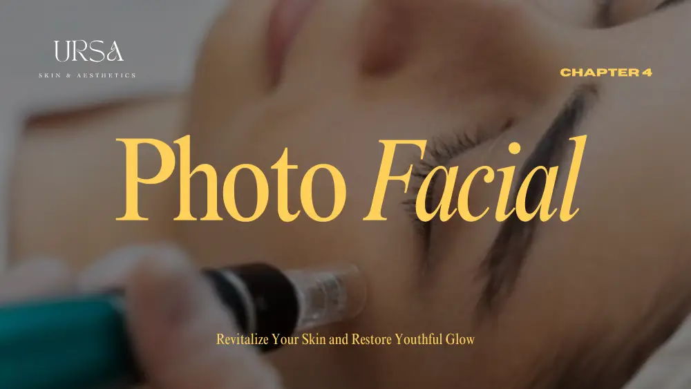 Photo Facial Treatment