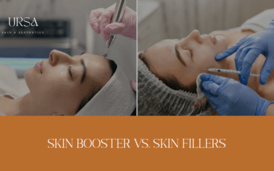 5 Benefits of Skin Booster Treatment That Skin Fillers Can’t Offer