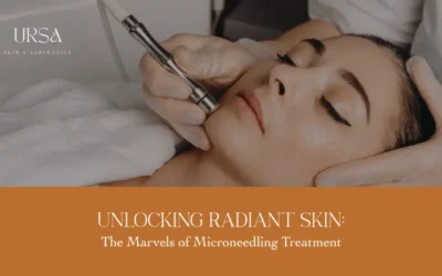 Know The Secret to Smooth, Youthful Skin With Microneedling Treatment