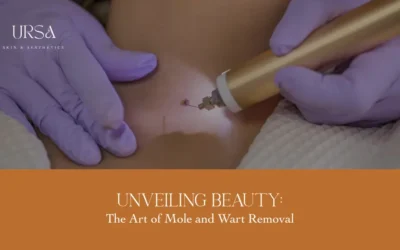 Pain-Free Wart Removal Treatment Options That Really Work