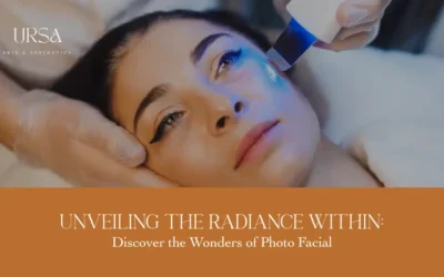 Photo Facial Treatment: Revitalize Your Skin and Restore Youthful Glow