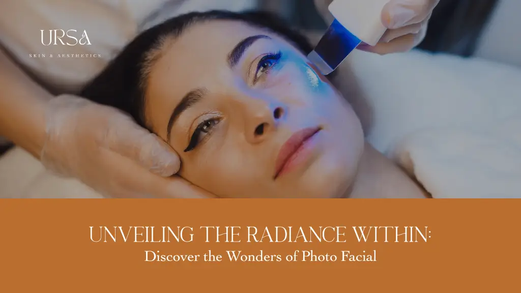 Photo Facial Treatment: Revitalize Your Skin and Restore Youthful Glow