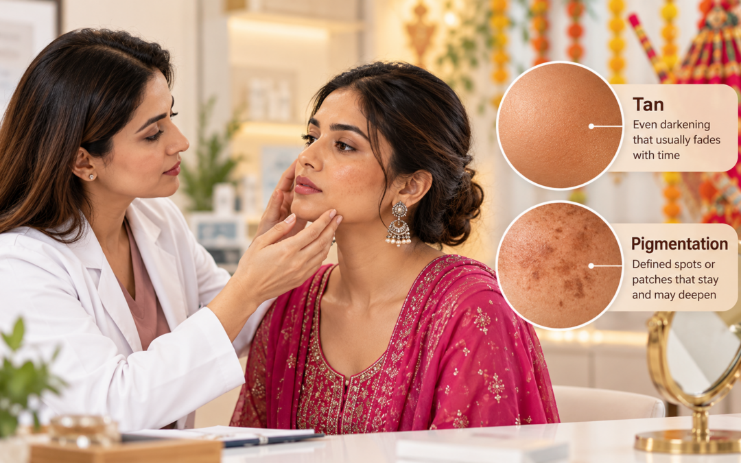 Pigmentation or Just a Festival Tan? How to Tell the Difference This Navratri